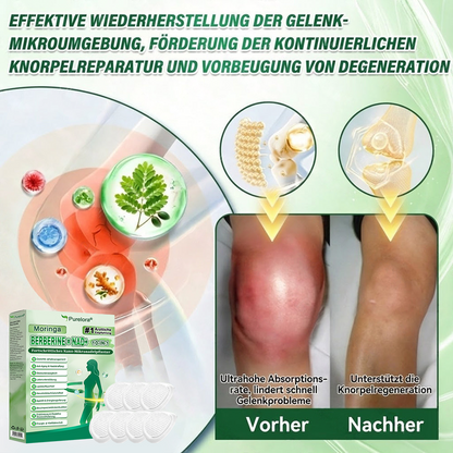 💖𝑶𝒏𝒍𝒊𝒏𝒆-𝑨𝒑𝒐𝒕𝒉𝒆𝒌𝒆💖丨Purelora® Moringa Berberinex NAD+ 10-in-1 Nano-Mikronadel-Patch (Nur einmal täglich, sichtbare Veränderungen in 7 Tagen) ✅ Für Übergewicht, lockere Haut, Diabetes, Schlafapnoe, Gelenkprobleme und mehr