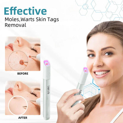 ✨✨✨✨✨QIAWI™ All-in-One CO₂ Laser Eraser Pen | Removes Moles, Warts, Skin Flaws & Pigmentation