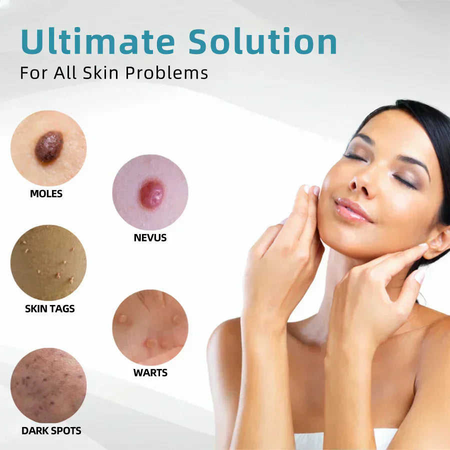 ✨✨✨✨✨QIAWI™ All-in-One CO₂ Laser Eraser Pen | Removes Moles, Warts, Skin Flaws & Pigmentation